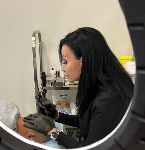 SMP hårpigmentering behandling Stockholm - Star Hair Clinic specialist