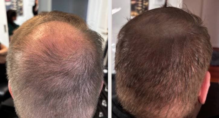 SMP bakifrån - naturlig virvel Marcus