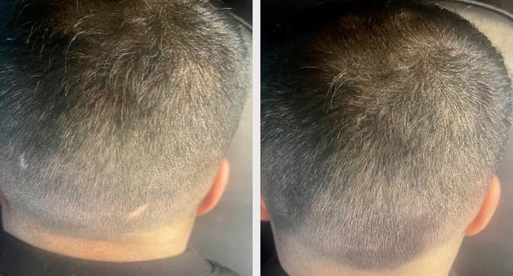 SMP före efter - Rizvan transformation